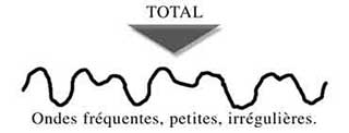 ondes fréquentes irrégulières