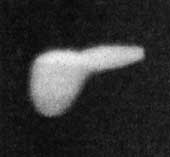 OVNI ou lueur diffuse